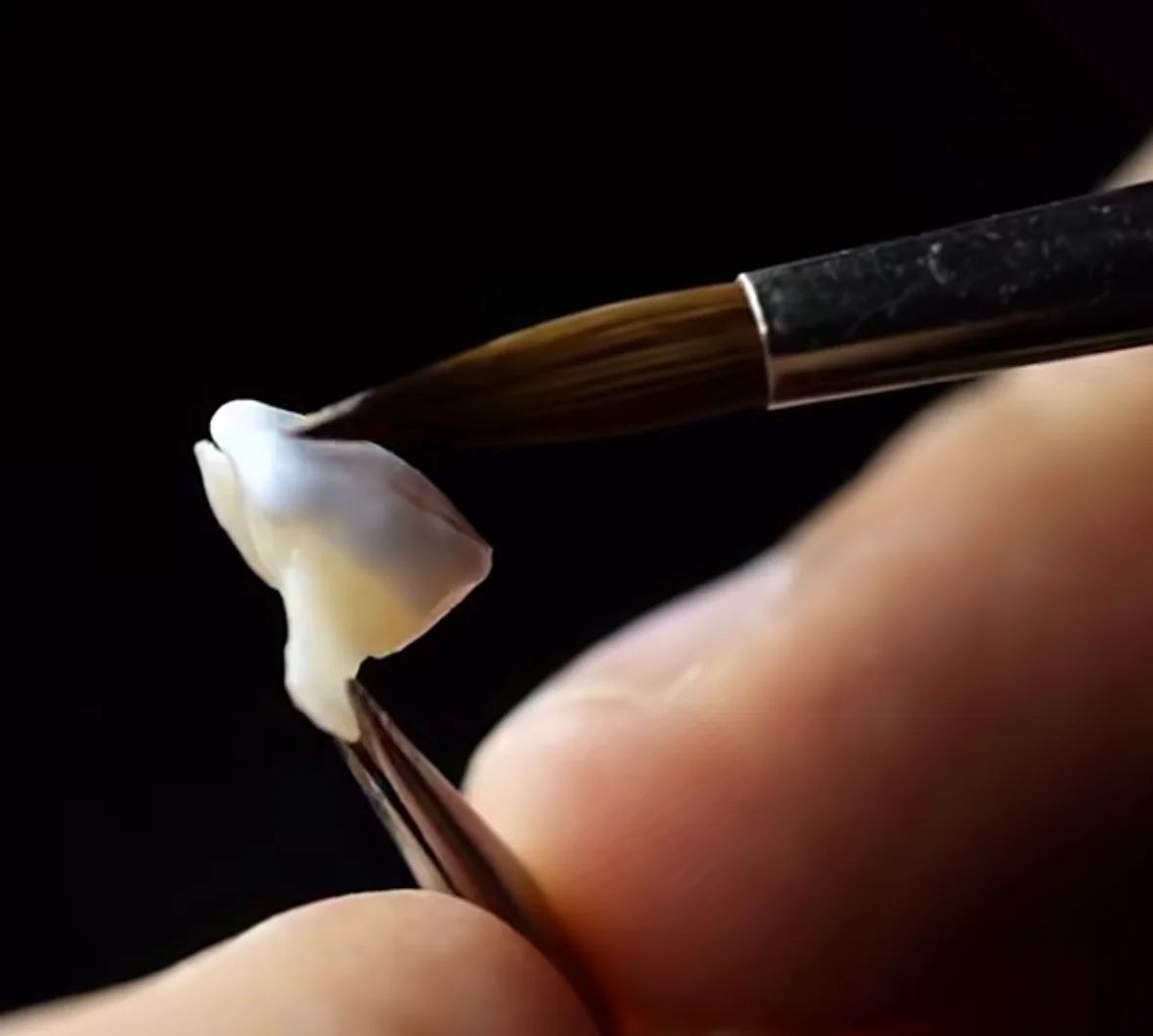 Céramiste partenaire - restaurations sur mesure Dr Bouganim