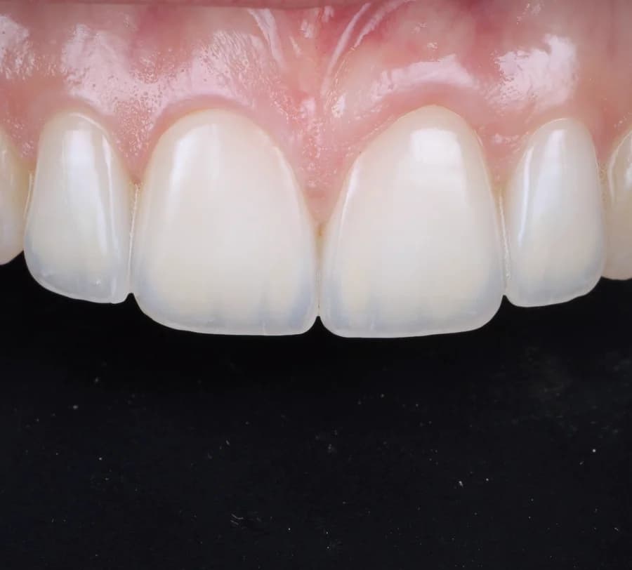 Intégration biologique des réhabilitations esthétiques - Dr Bouganim